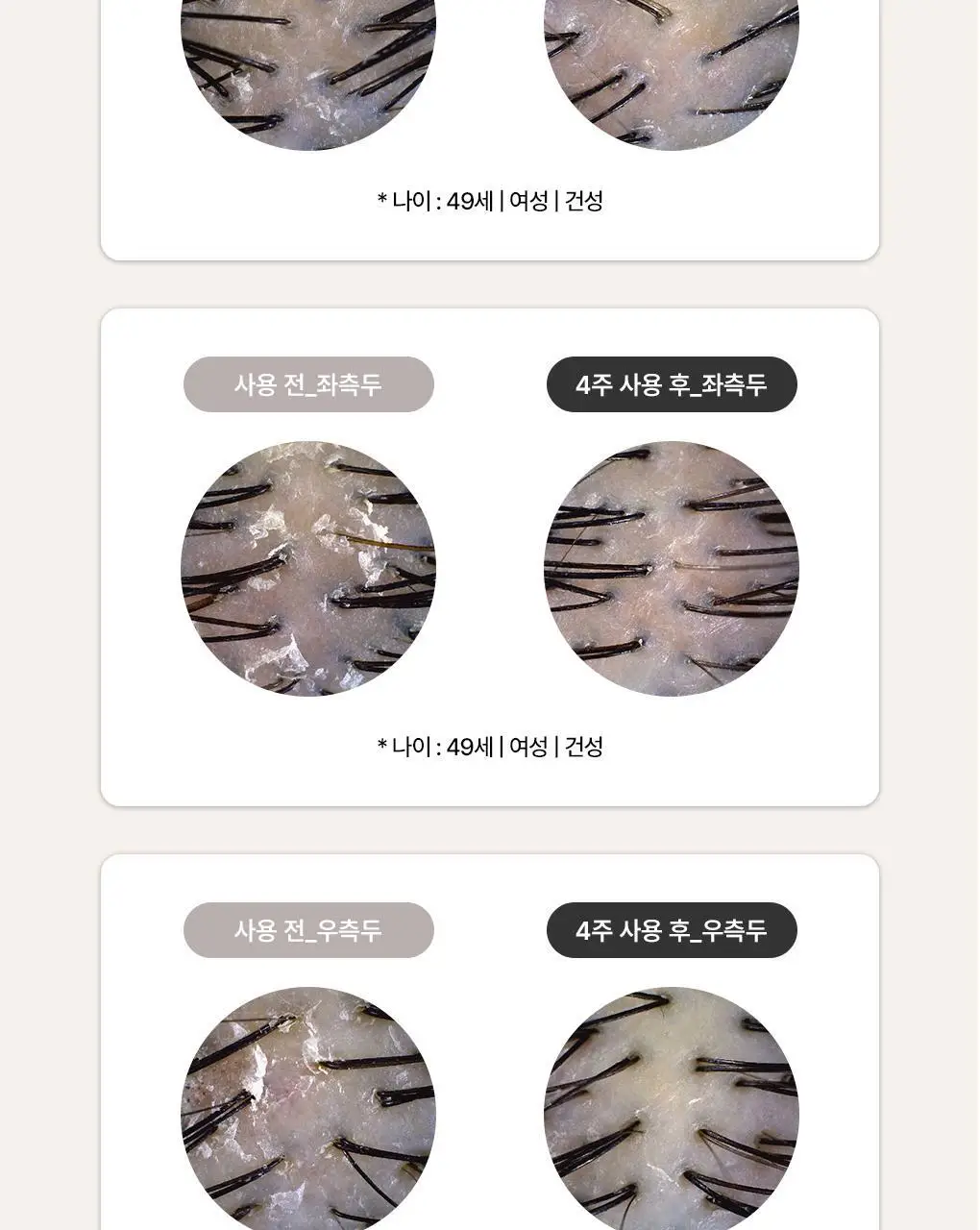[1등비듬샴푸]라우쉬 콜츠푸트 안티-댄드러프 샴푸 200ml 2입기획 상세페이지 8